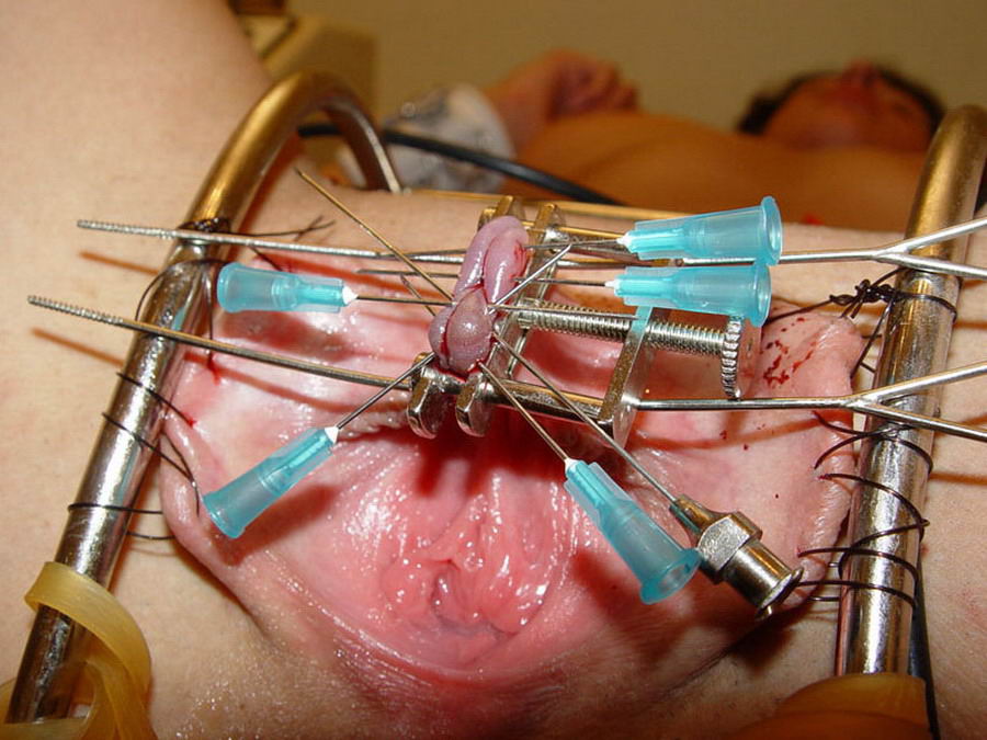 FFFFFFFFFFFFFFFFFFF ouch