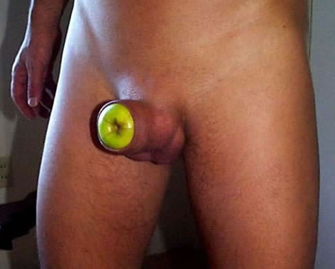 apple in foreskin