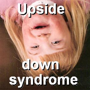 upside down syndrome